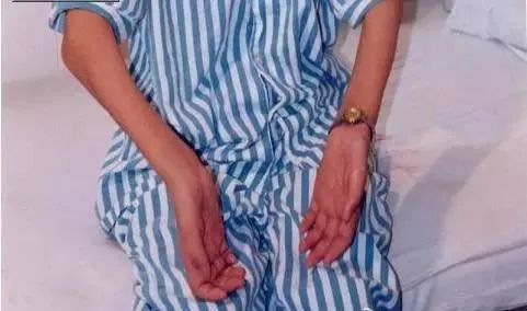 肌肉萎缩能逆转吗,肌肉萎缩神经受损还能恢复吗