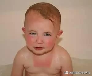 防晒霜儿童一般防晒指数,儿童防晒最好的产品推荐