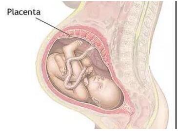 胎盘位置到底怎么看？