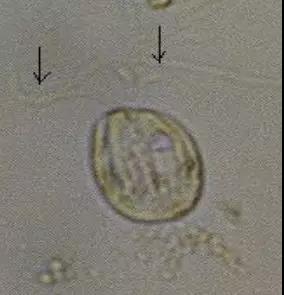 污泥镜检操作方法,污泥检测项目及标准有哪些呢