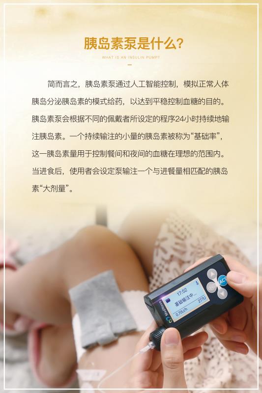 优泵胰岛素泵最新价格,胰岛素泵价格趋势