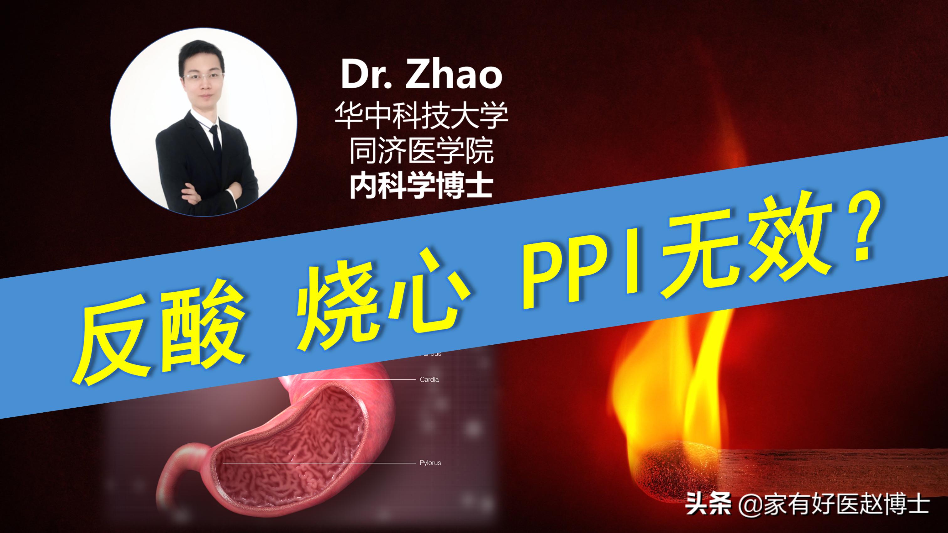 反酸烧心吃雷贝拉唑配什么,拉唑类药物治反酸哪个效果好