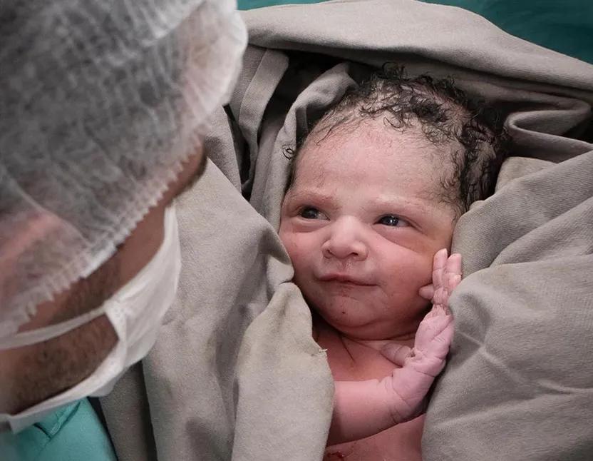 剖宫产的真实故事,剖宫产经历九死一生