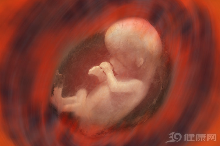 羊水过多最好控制办法,羊水多孕妇应怎么注意