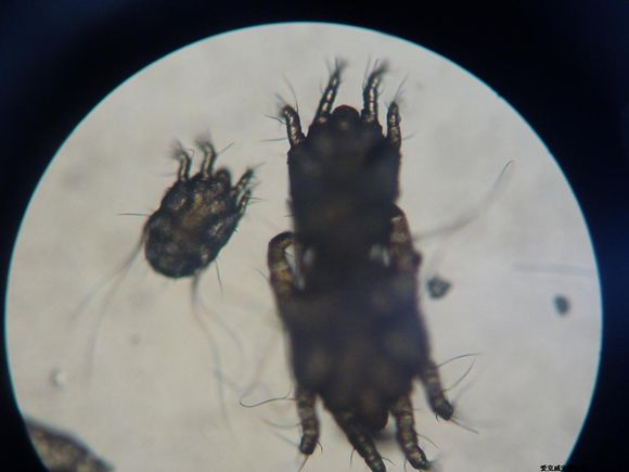 家养猫得猫癣和耳螨的原因,预防猫耳螨日常护理用什么