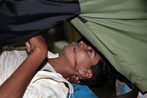 怎么应对持刀杀人事件,如何在刑事案件中自救