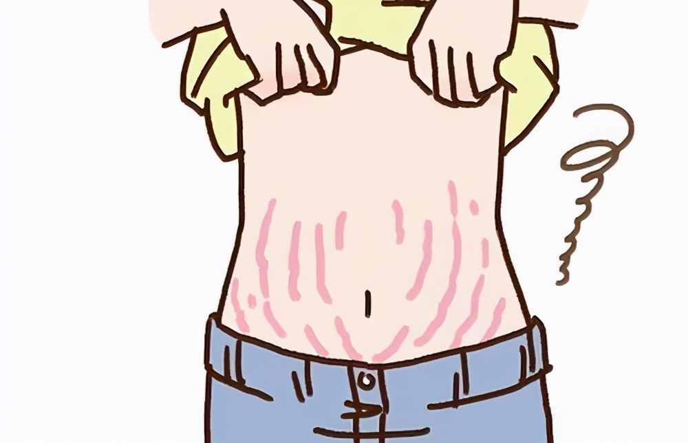 不胖但是有胖纹,不胖也不壮是虚胖吗