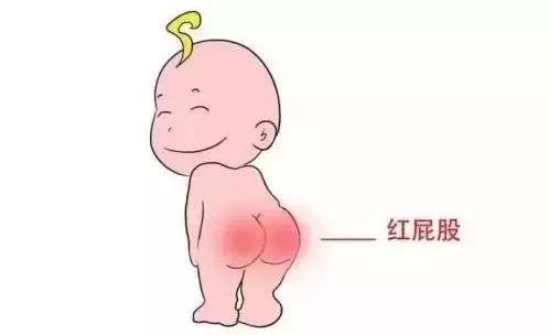 宝宝黄疸吐奶便秘,30天婴儿黄疸吐奶严重