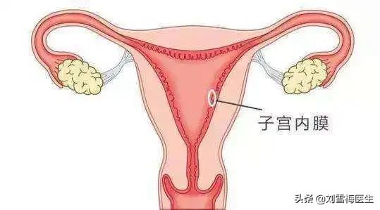怀上了却留不住?这3大元凶让你的子宫内膜越来越薄