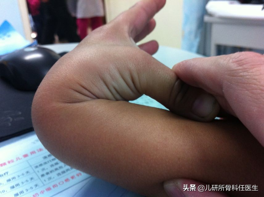 孩子出门玩耍担心牵拉肘？爸爸妈妈看这一篇就够了