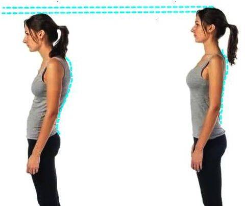 强直性脊柱炎最典型和常见的症状,强直性脊柱炎需要注意的地方