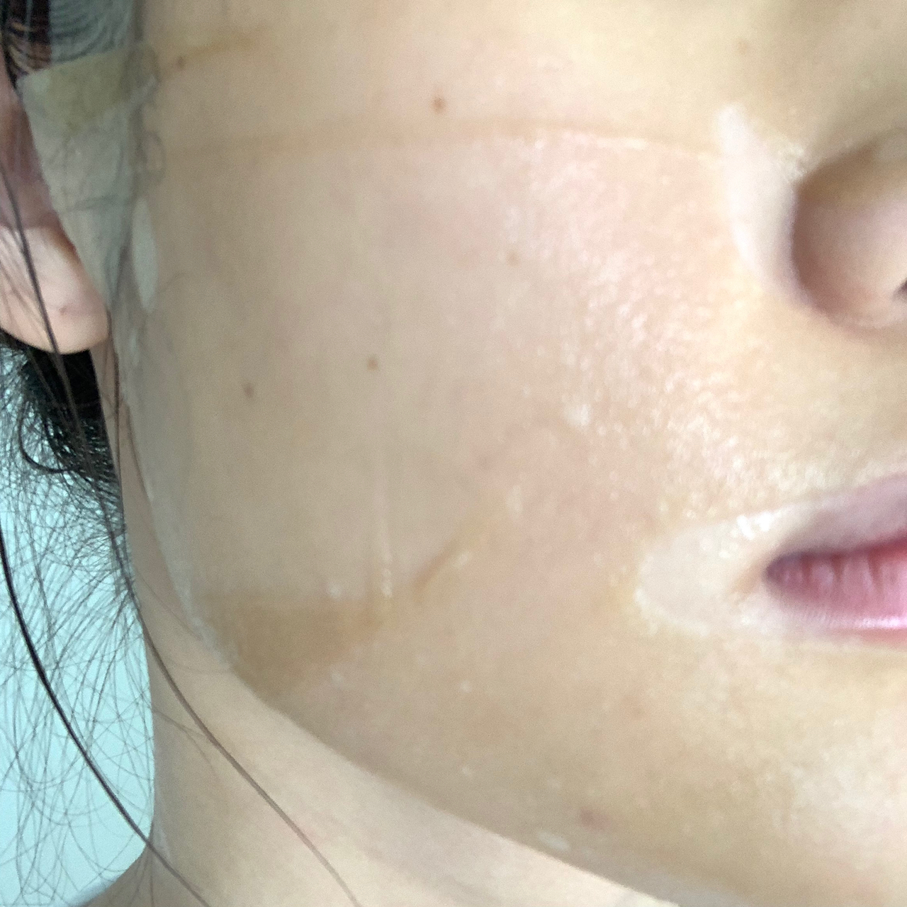 长痘痘的脸怎么拯救下去,长痘痘的肌肤怎么修复