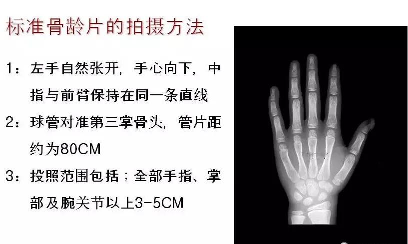 孩子个子高却跑不快,孩子个头不高怎么办