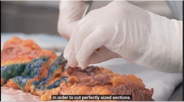 病理报告为什么这么慢,手术后病理报告准确率高吗