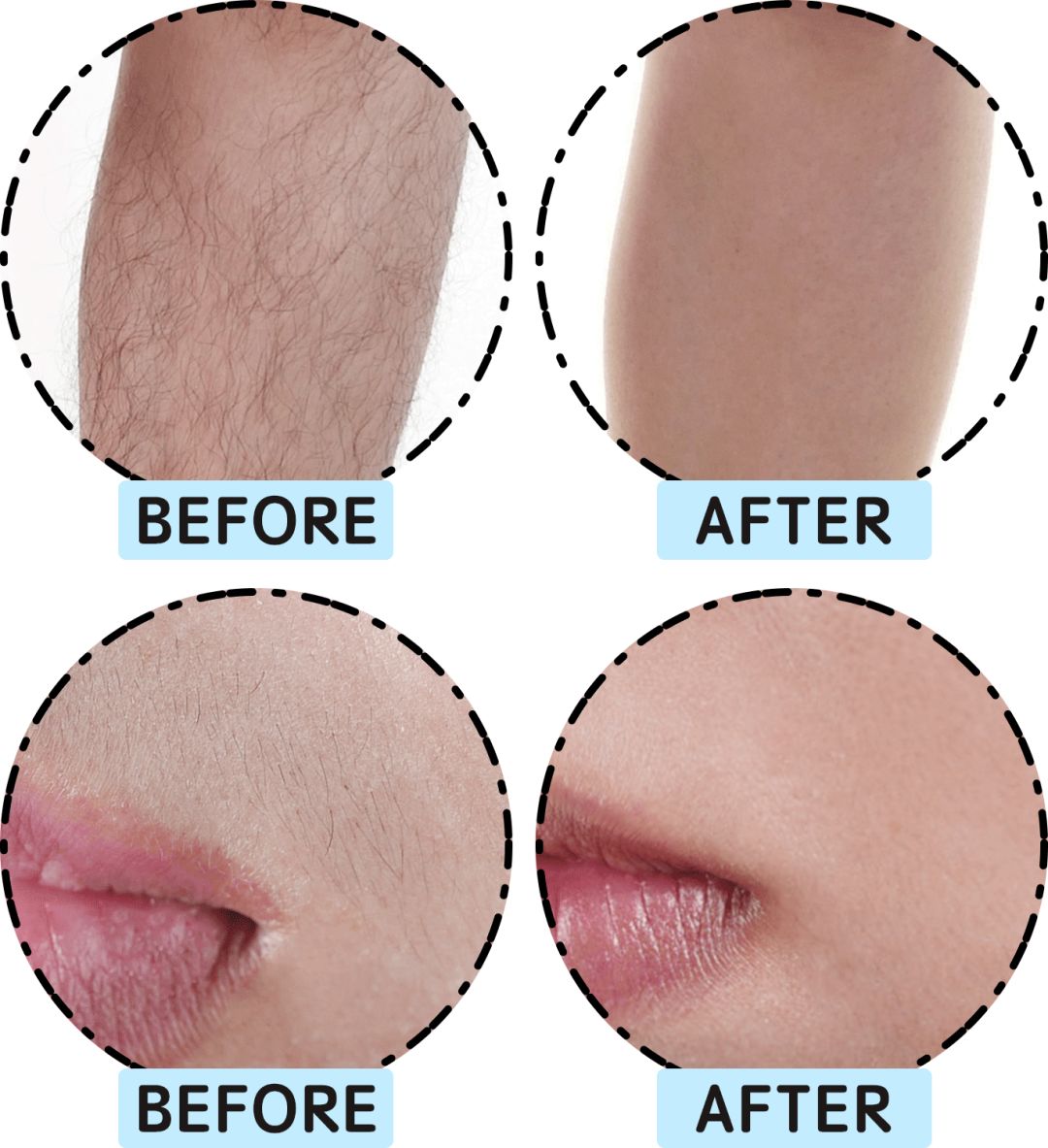 评测市面热销脱毛仪,jovs兰博基尼脱毛仪和ulike哪个好