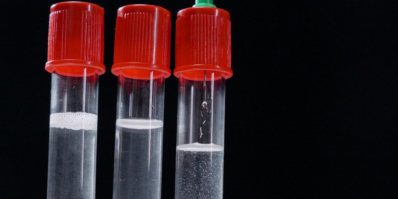 9成国人不会挑选加湿器：翻阅30万字论文，只为教你正确应对干燥