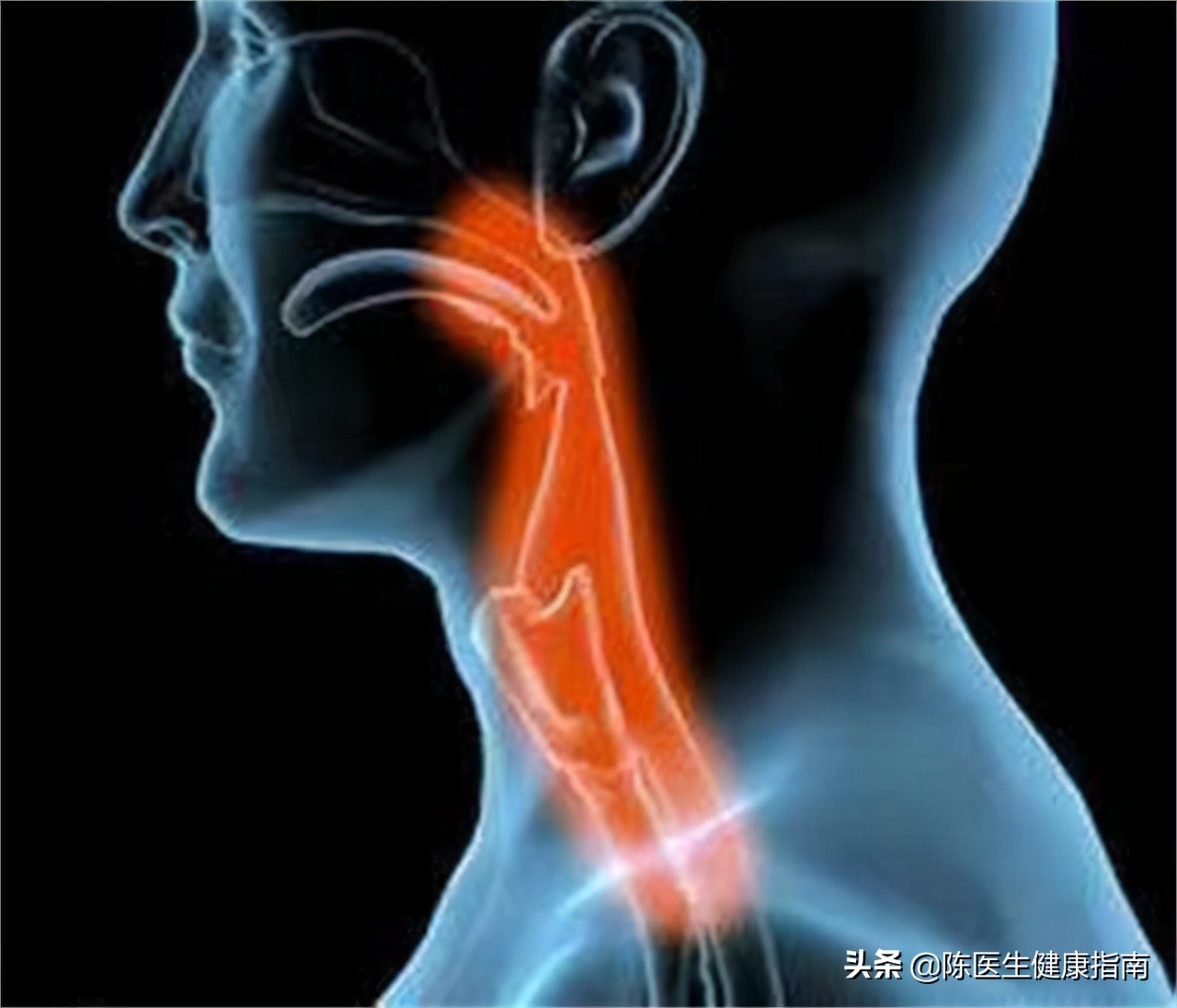 阿莫西林别滥用只针对这六种病,阿莫西林列入十种不能吃的药