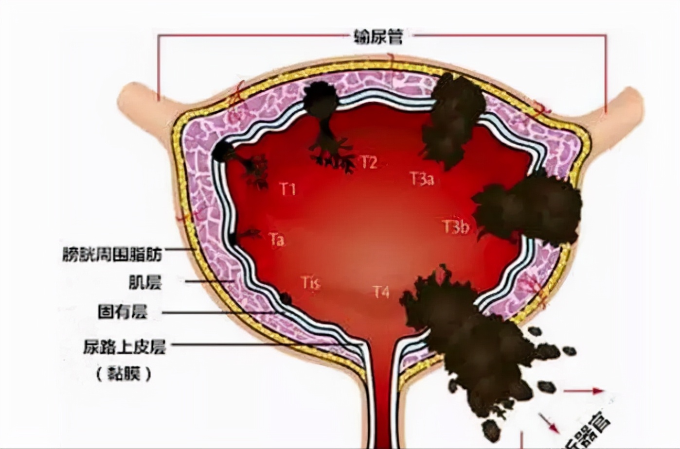 尿急是什么意思严重吗,尿急是什么意思流行用语
