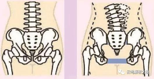 开胯和松胯的特殊方法,髋关节,骶骨,尾骨,腰关节的详细介绍