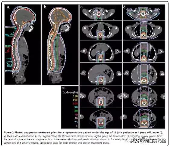 质子治肿瘤怎么样,儿童肿瘤质子治疗好吗