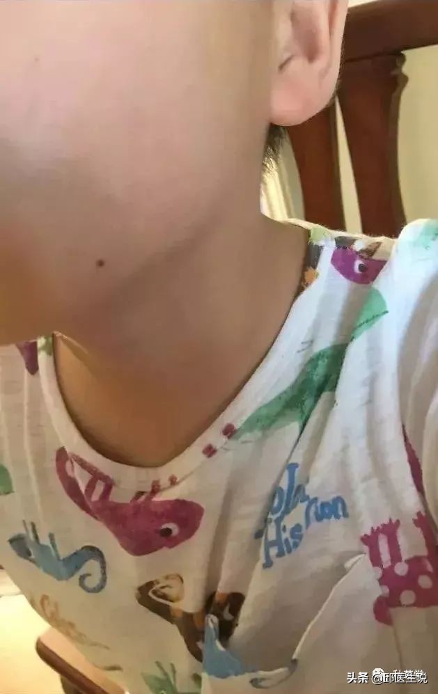 治疗皮肤瘙痒的中医有效便方