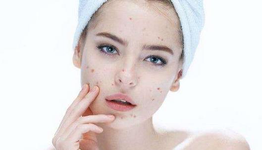 换季长痘怎么快速消除,秋季上火怎么调理最有效