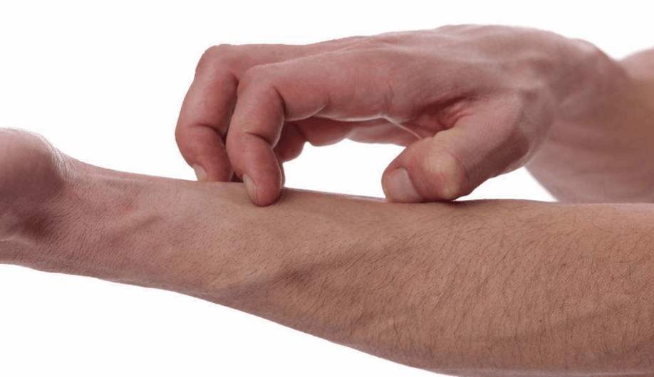 各个部位长痘痘的原因及解决方法,各个部位长痘痘的原因和改善方法