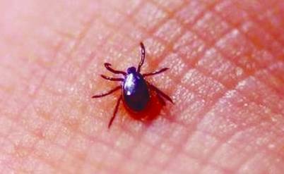 身上有针尖大小黑点,身上出现不明黑点