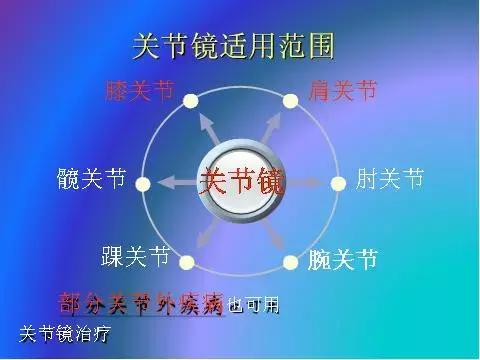 “石岛”在线|“小镜子”发挥大作用,关节疾病可以“精”治疗