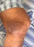 贴膝盖穴位贴药效有多长时间,膝关节疼贴药贴效果好