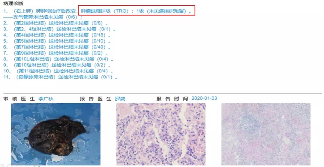 肺癌晚期可以靶向加免疫治疗吗,肺癌晚期化疗加免疫治疗有效吗