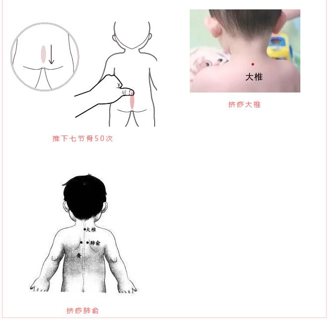 孩子半夜老咳嗽怎么缓解,孩子半夜咳嗽厉害怎么办中医