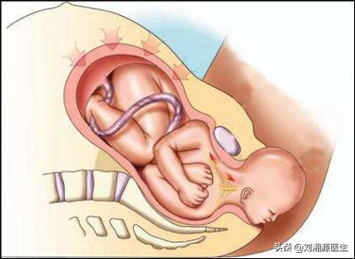 「免疫相关不良妊娠答疑解惑40」——系统性血管炎