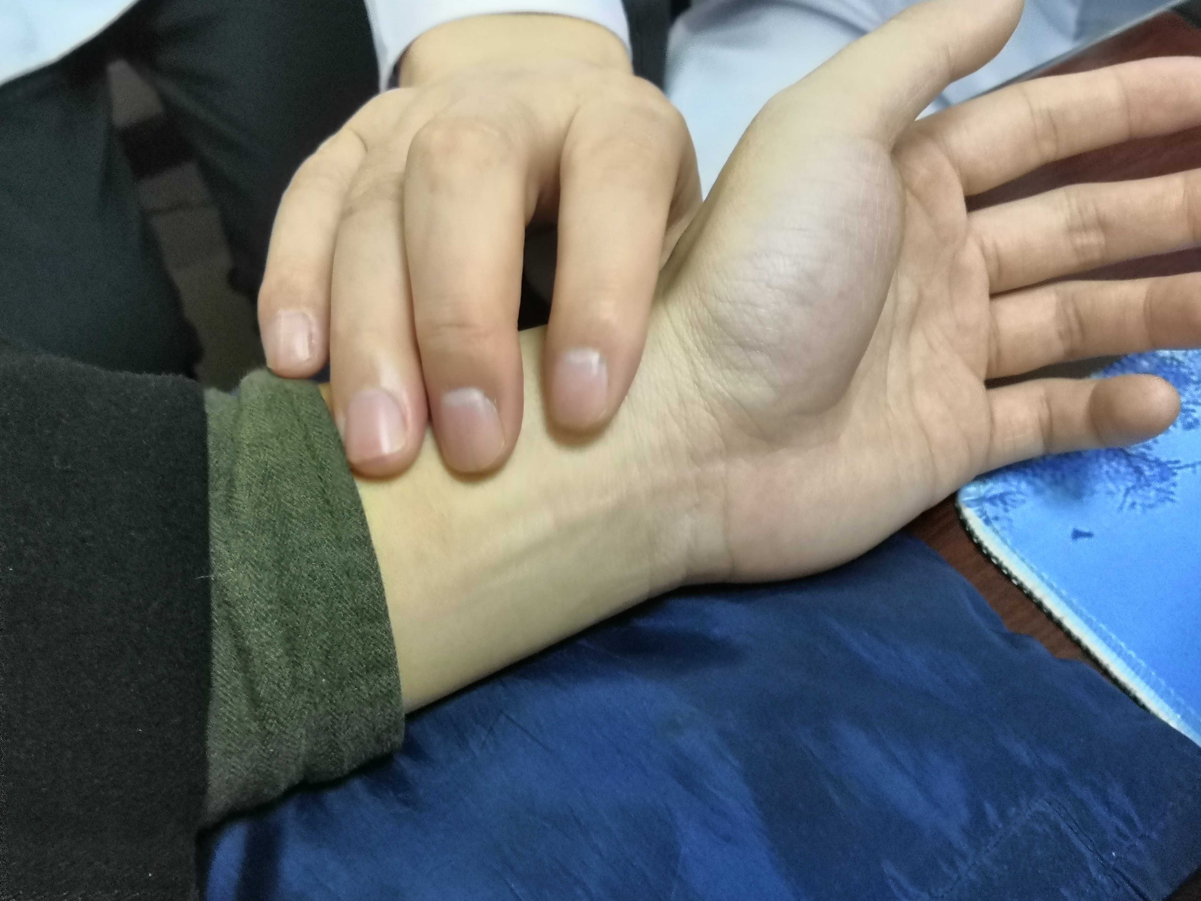 一个疗程就改善了他的尿频症状,医生说出了原因