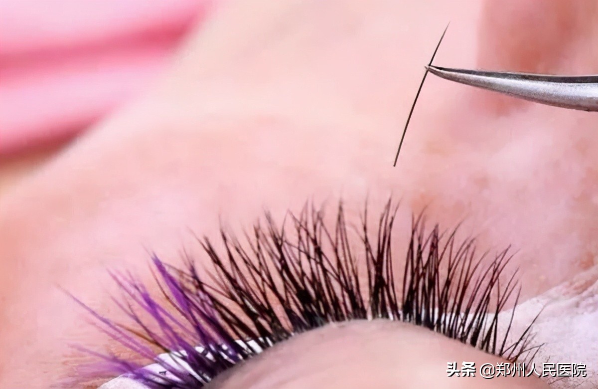 每天掉睫毛需要警惕吗,睫毛掉光会怎么样