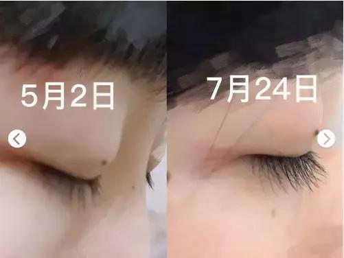 怎么挑选一款适合的眼霜,怎么选择一款适合自己的眼霜