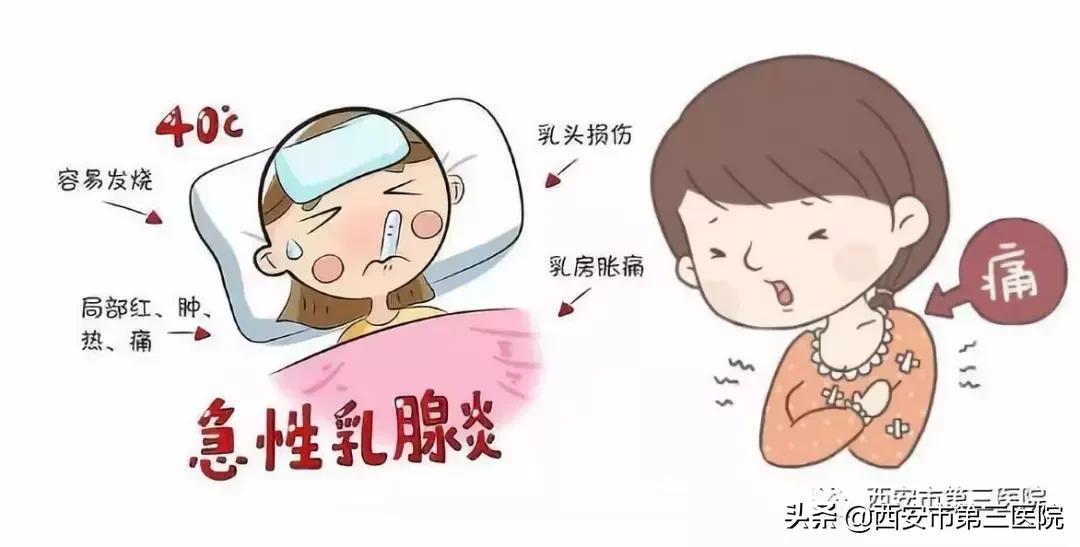 哺乳期乳腺炎的病因及治疗,专家说哺乳期如何防治急性乳腺炎