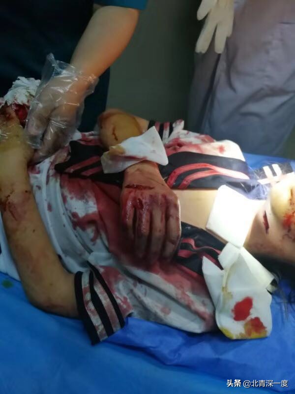 警方回应女童被后妈虐待致死,后妈伤童案