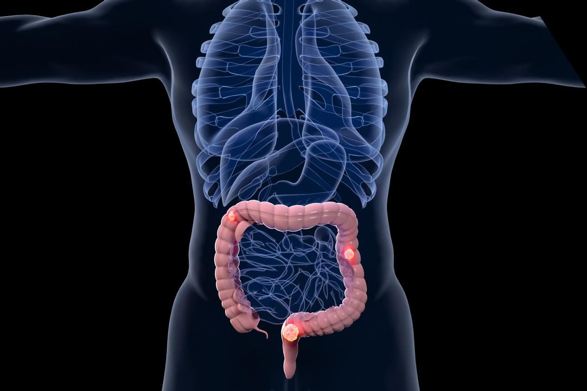 左腹部疼痛的可能病因做什么检查,左边腹部疼检查不出原因如何缓解