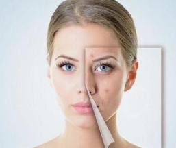 红霉素软膏涂脸会闷痘么,红霉素软膏涂在脸上会留疤吗