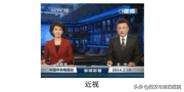 中医认为散光是怎么造成的,医生怎么发现散光