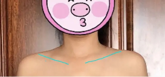 斜方肌太大怎么练视频,斜方肌太大了怎么练哑铃