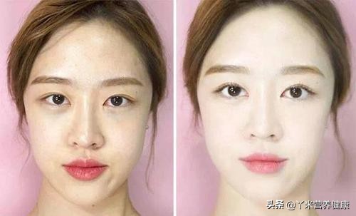 女性防护益生菌,蔓越莓益生菌对妇科炎症有效果吗