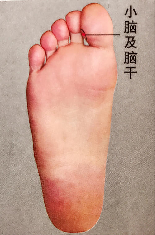 徒手快速解决疼痛,快速止痛100种点按法可靠吗