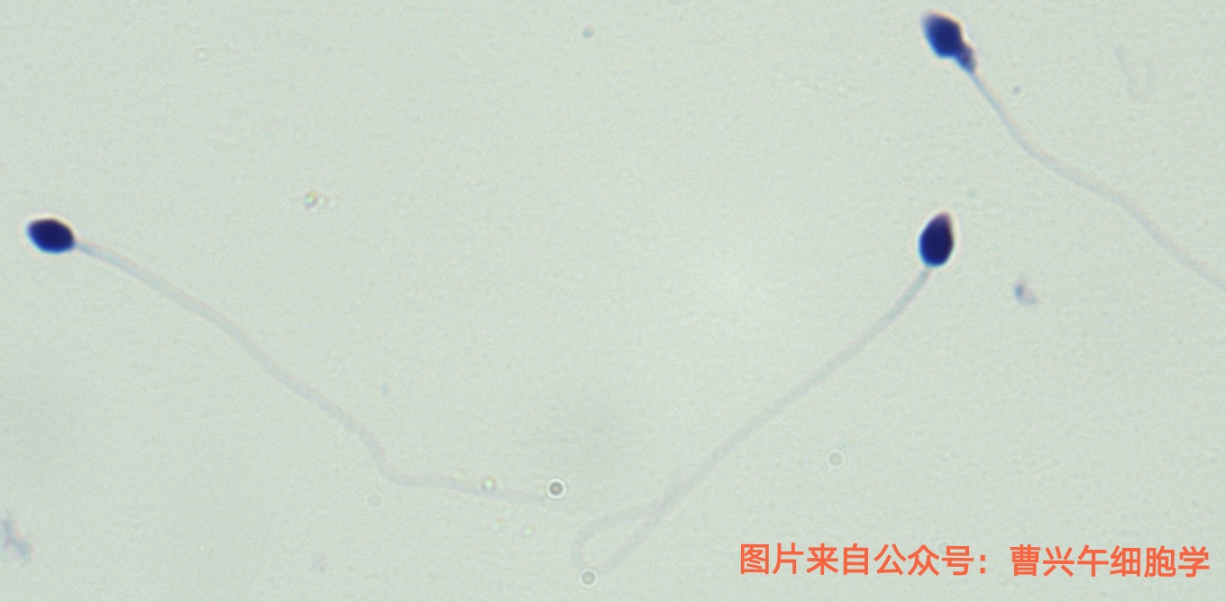 男科诊疗纪实,男科专家谈精子系列