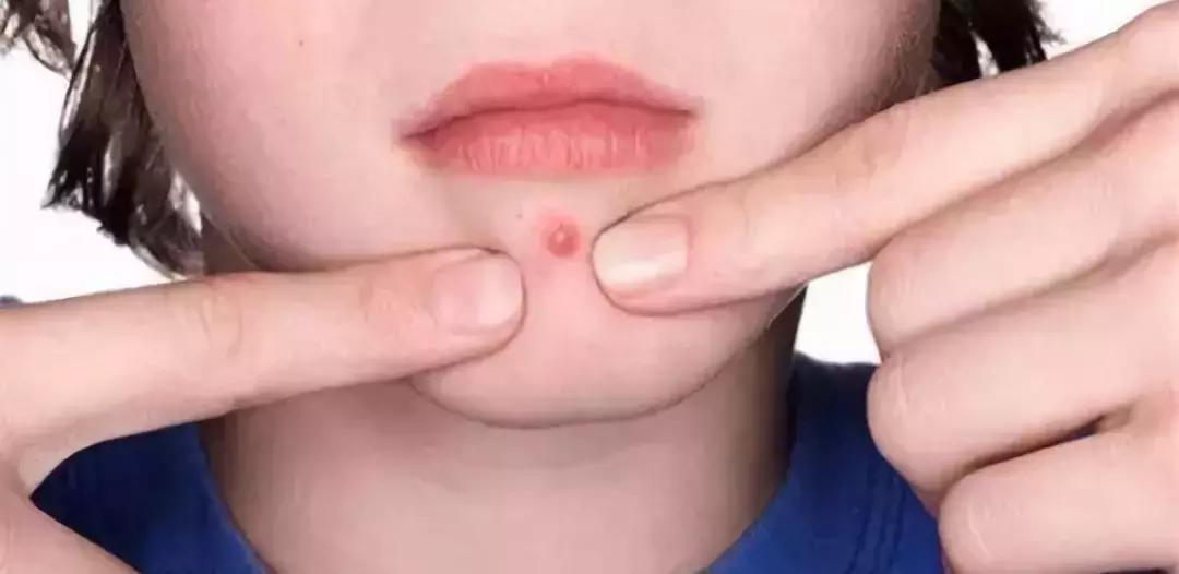 玫瑰果油护肤油好用吗,玫瑰果油效果怎么样