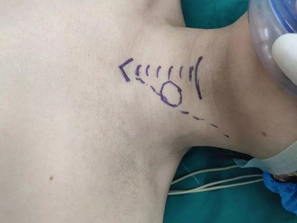 长治市第二人民医院激光手术,长治市第二人民医院外科