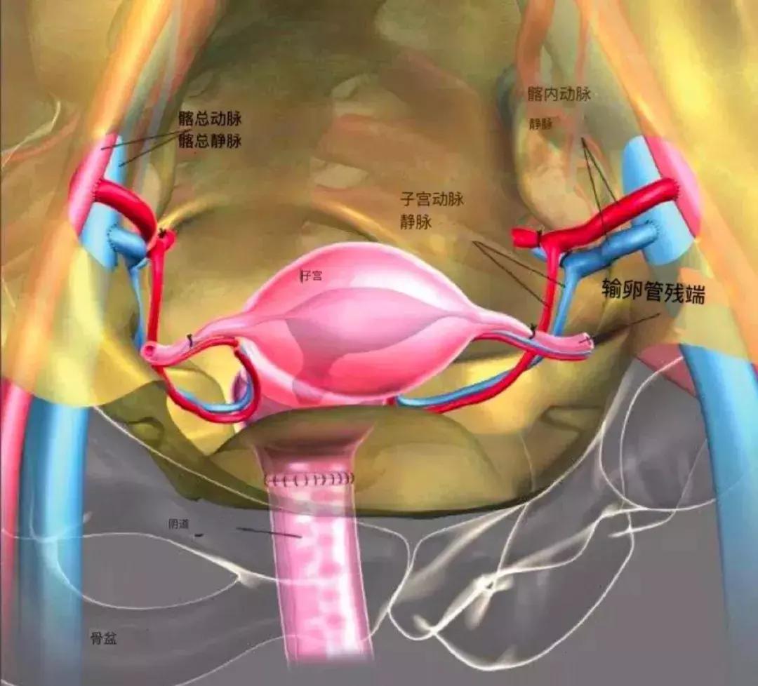 母亲移植子宫给22岁女儿,重金高风险求子值得吗?