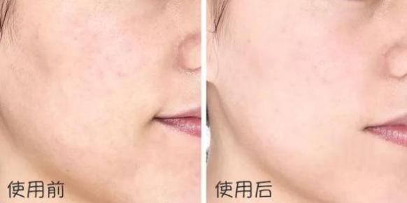 澳大利亚财政部长首推品牌,进国后让柳岩薇娅同时着迷,太疯狂了