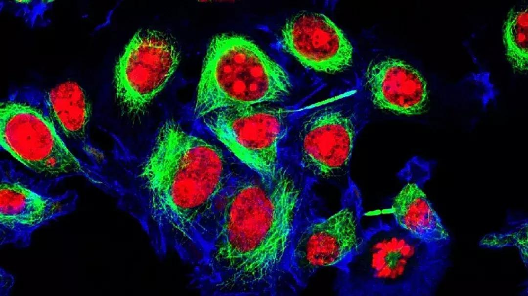 科学家找到癌细胞的生死开关,科学家找到了癌症的开关